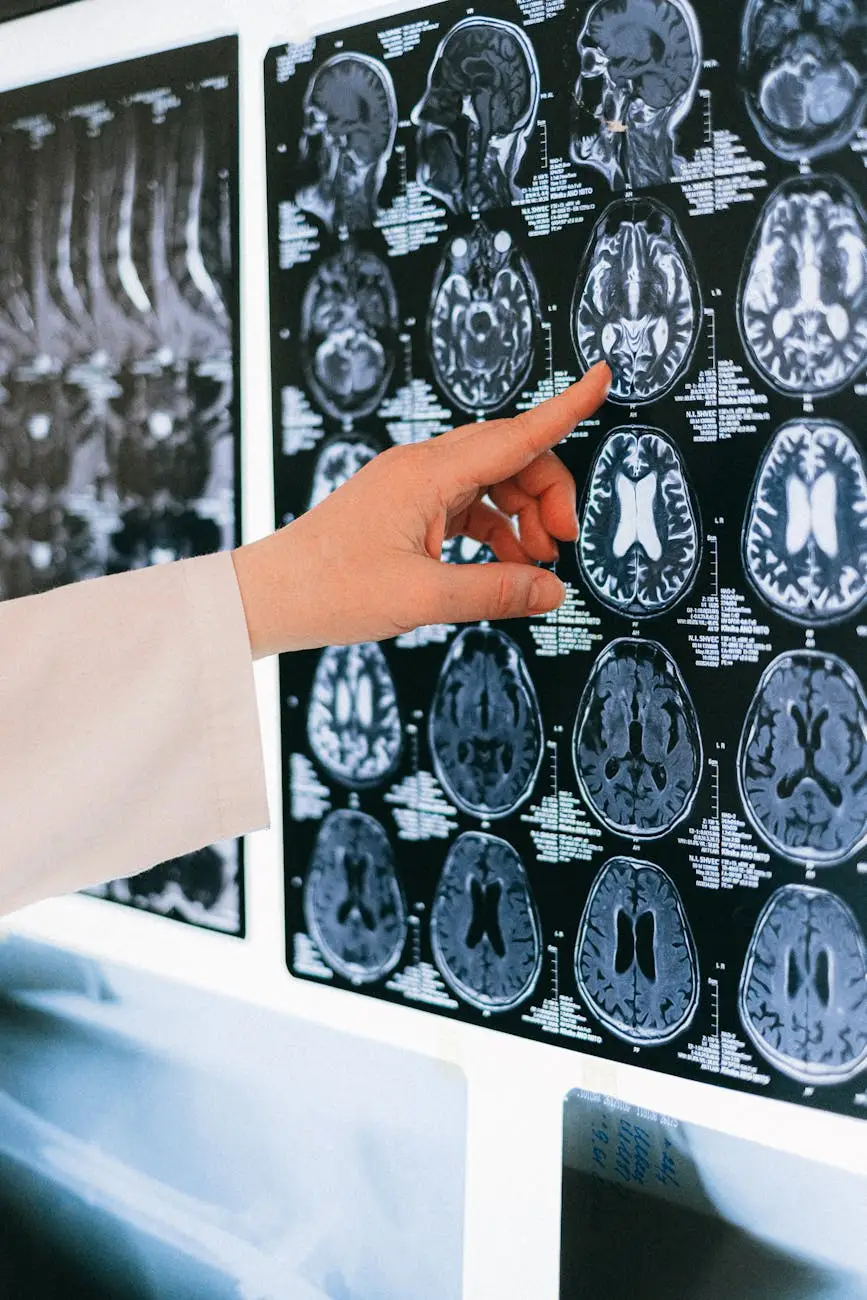 Otimização Cognitiva: Nootrópicos e a Neurobiologia da Performance