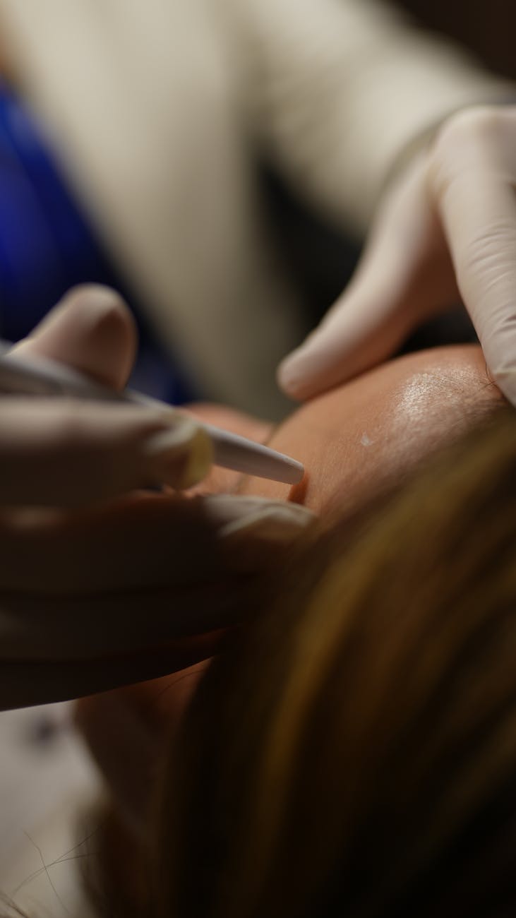 Silo Estético Mivonne: Guia de Procedimentos Dermatológicos