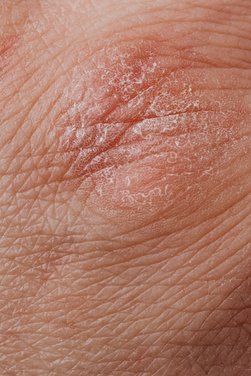 Guia de Tratamentos Dermatológicos: Ciência e Resultados