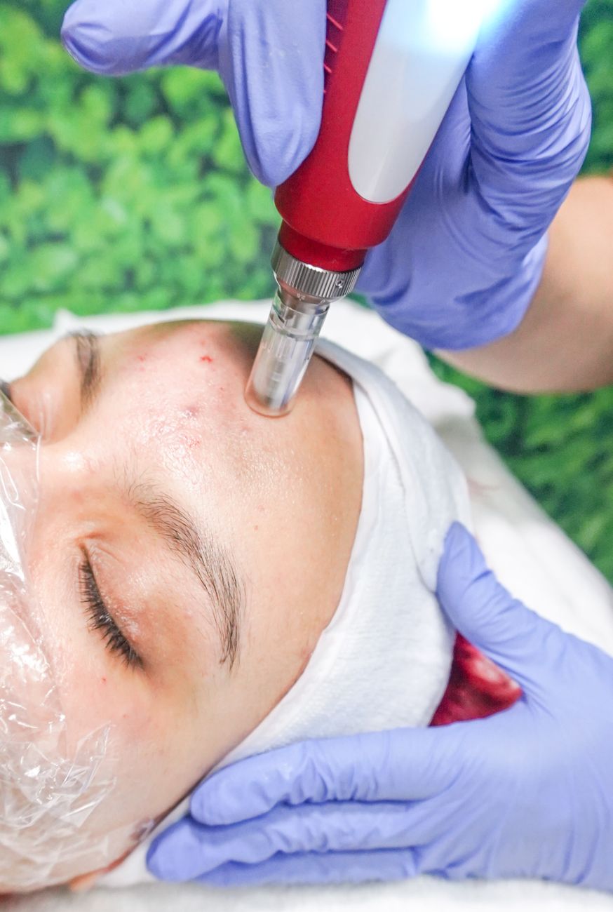Skincare Pós-Exaustão da Anitta: O Guia de Alta Performance